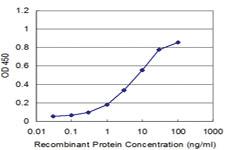 Anti-ACAA2 Mouse Monoclonal Antibody [clone: 2F7]