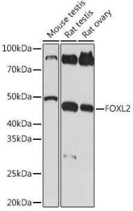 Western blot analysis of extracts of various cell lines, using Anti-FOXL2 Antibody [ARC2055] (A307530) at 1:1,000 dilution The secondary antibody was Goat Anti-Rabbit IgG H&L Antibody (HRP) at 1:10,000 dilution Lysates/proteins were present at 25 µg per lane