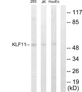 Western blot analysis of lysates from 293, Jurkat, and HUVEC cells using Anti-KLF11 Antibody The right hand lane represents a negative control, where the antibody is blocked by the immunising peptide