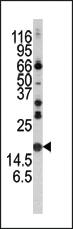 Anti-SNCA Rabbit Polyclonal Antibody