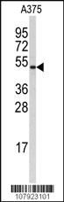 Anti-CCNB1 Rabbit Polyclonal Antibody