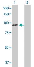 Anti-CPT1A Rabbit Polyclonal Antibody