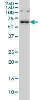 Anti-CCDC6 Mouse Monoclonal Antibody [clone: 5D11]