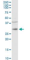 Anti-CER1 Rabbit Polyclonal Antibody