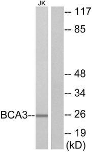 Western blot analysis of lysates from Jurkat cells using Anti-BCA3 Antibody. The right hand lane represents a negative control, where the antibody is blocked by the immunising peptide