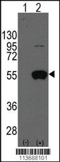 Anti-MEF2D Rabbit Polyclonal Antibody