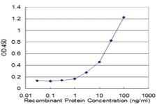 Anti-CPT1A Mouse Monoclonal Antibody [clone: 1D3]