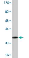 Anti-CCDC132 Mouse Monoclonal Antibody [clone: 2D11]