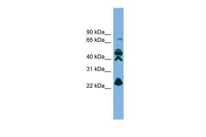 Anti-RPE Rabbit Polyclonal Antibody