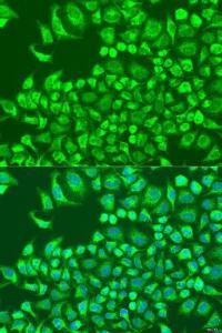 Immunofluorescence analysis of U2OS cells using Anti-CST6 Antibody (A10301) at a dilution of 1:100. DAPI was used to stain the cell nuclei (blue).