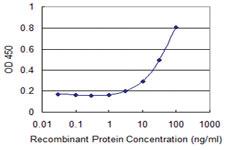 Anti-ETFA Mouse Monoclonal Antibody [clone: 2A5]