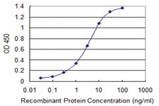 Anti-CCDC6 Mouse Monoclonal Antibody [clone: 5D11]