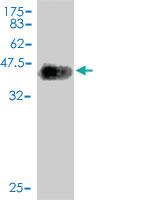 Anti-NLGN4Y Mouse Monoclonal Antibody [clone: 1E4]