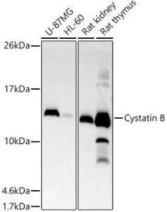 Western blot analysis of extracts of various cell lines, using Anti-Cystatin-B Antibody [ARC2833] (A307531) at 1:500 dilution