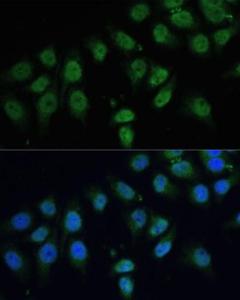 Antibody A308500-100 100 µl