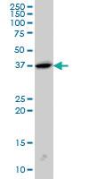 Anti-SH3GL2 Mouse Monoclonal Antibody [clone: 5A6]