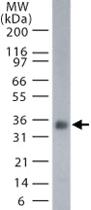 Anti-TNFSF11 Mouse Monoclonal Antibody [clone: 12A380]