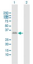 Anti-CER1 Rabbit Polyclonal Antibody