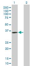 Anti-CRELD2 Mouse Polyclonal Antibody