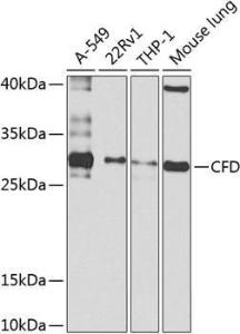 Western blot analysis of extracts of various cell lines, using Anti-Factor D/CFD Antibody (A10302) at 1:1,000 dilution