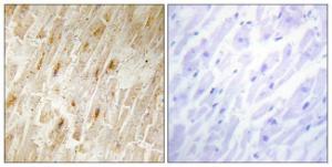 Immunohistochemical analysis of paraffin-embedded human heart tissue using Anti-BCA3 Antibody. The right hand panel represents a negative control, where the antibody was pre-incubated with the immunising peptide