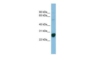 Anti-RPL10A Rabbit Polyclonal Antibody