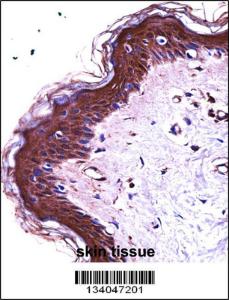 Anti-S100A7 Rabbit Polyclonal Antibody (HRP (Horseradish Peroxidase))