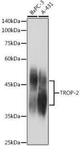 Anti-TROP2 antibody