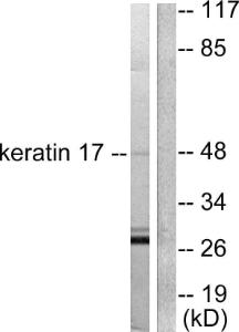 Western blot analysis of lysates from HUVEC cells using Anti-Keratin 17 Antibody. The right hand lane represents a negative control, where the antibody is blocked by the immunising peptide.