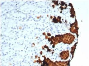 Immunohistochemical analysis of formalin-fixed, paraffin-embedded human stomach tissue using Anti-Mucin 5AC Antibody [MUC5AC/7067R]