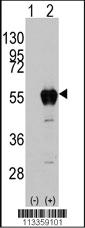 Anti-ALDH2 Rabbit Polyclonal Antibody