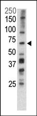 Anti-PINK1 Rabbit Polyclonal Antibody