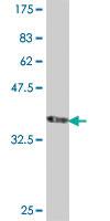 Anti-CACNB2 Mouse Polyclonal Antibody