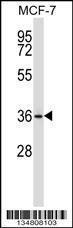 Anti-MAP2K3 Rabbit Polyclonal Antibody (Biotin)