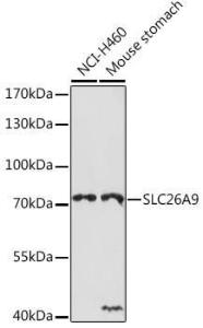 Anti-SLC26A9 Rabbit Polyclonal Antibody