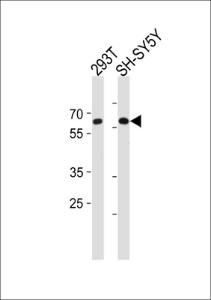 Anti-IRX3 Rabbit Polyclonal Antibody (HRP (Horseradish Peroxidase))