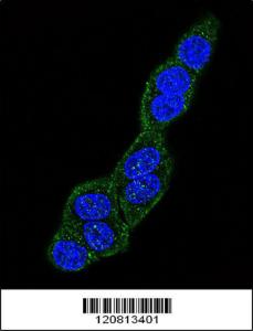 Anti-HSPA5 Rabbit Polyclonal Antibody (FITC (Fluorescein Isothiocyanate))