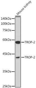 Anti-TROP2 antibody