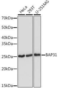 Western blot analysis of extracts of various cell lines, using Anti-BAP31 Antibody [ARC1894] (A308503) at 1:1,000 dilution