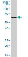 Anti-CPT2 Mouse Polyclonal Antibody