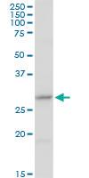 Anti-CER1 Rabbit Polyclonal Antibody