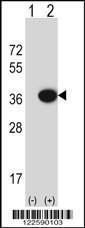 Anti-MARC2 Rabbit Polyclonal Antibody (Biotin)