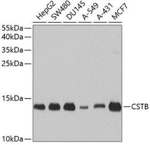 Western blot analysis of extracts of various cell lines, using Anti-Cystatin-B Antibody (A307532) at 1:1,000 dilution. The secondary antibody was Goat Anti-Rabbit IgG H&L Antibody (HRP) at 1:10,000 dilution.