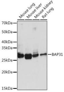 Western blot analysis of extracts of various cell lines, using Anti-BAP31 Antibody [ARC1894] (A308503) at 1:1,000 dilution