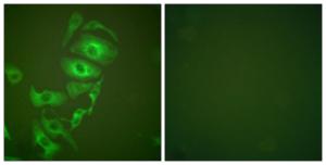 Immunofluorescence analysis of HepG2 cells using Anti-Keratin 17 Antibody. The right hand panel represents a negative control, where the antibody was pre-incubated with the immunising peptide.