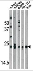 Anti-PARK7 Rabbit Polyclonal Antibody