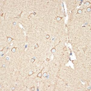 Immunohistochemistry analysis of paraffin-embedded human brain tissue using Anti-BAP31 Antibody [ARC1894] (A308503) at a dilution of 1:100 (40X lens). Perform microwave antigen retrieval with 10 mM Tris/EDTA buffer pH 9.0 before commencing with IHC staining protocol