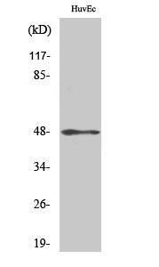 Western blot analysis of various cells using Anti-Keratin 17 Antibody