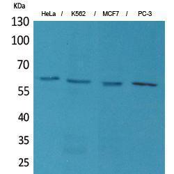 Antibody anti-TP63 100 µg