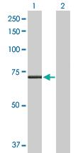 Anti-CPT2 Rabbit Polyclonal Antibody